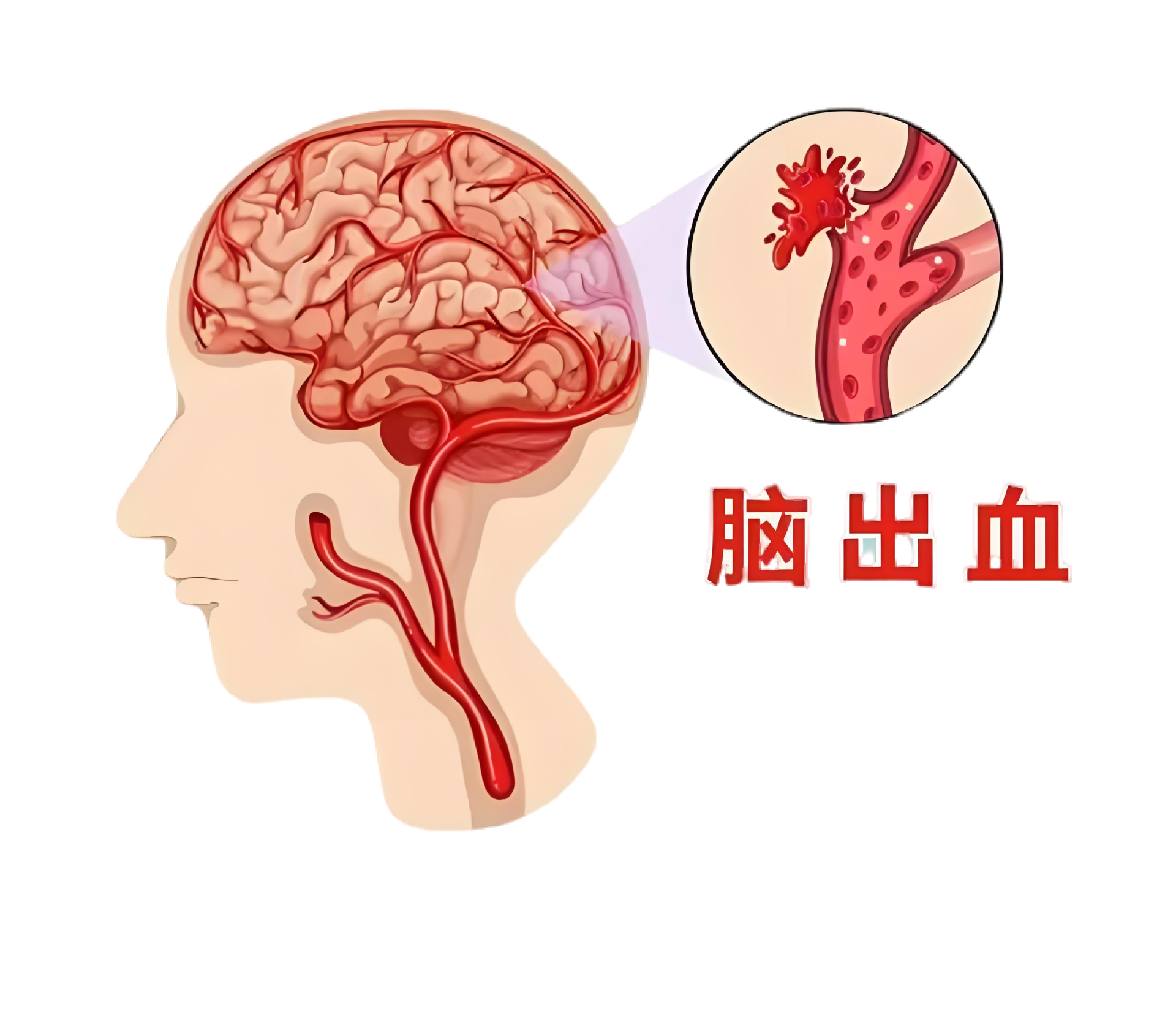 1745302978558-ckt-摳圖.png